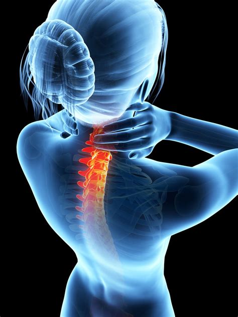 Can Rheumatoid Arthritis Affect The Spine