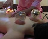 Cupping Glass Therapy Photos