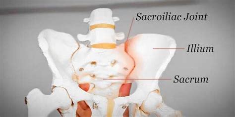 Si Joint Chiropractic Treatment
