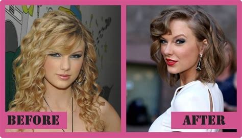 Taylor Swift Plastic Surgery With Before And After Photos