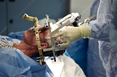 Deep Brain Stimulation Surgery Stock Image C0360658 Science