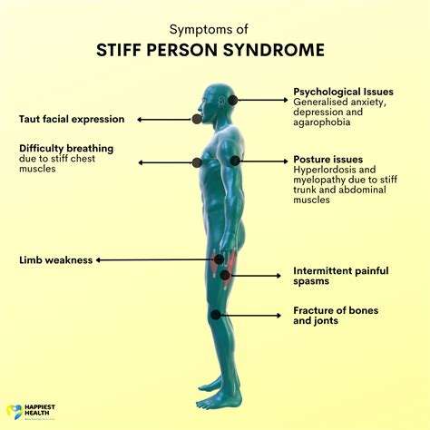 When Muscles Rebel Stiff Person Syndrome Happiest Health