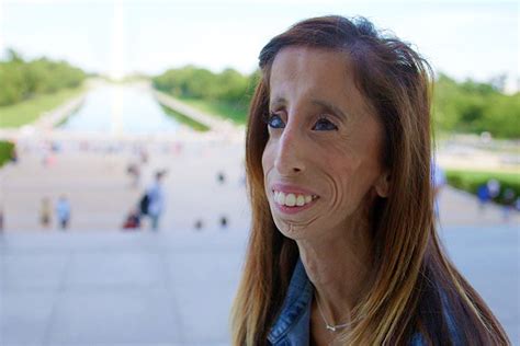 Person Of The Day Lizzie Velasquez Stars In New Anti Bullying