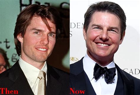 Tom Cruise Cosmetics Plastic Surgery Before And After Face Photos