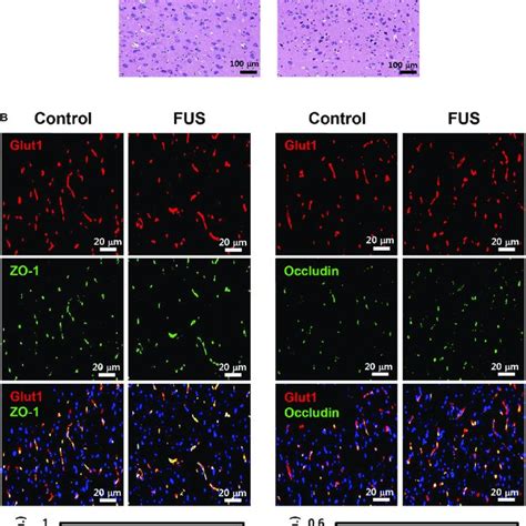 Histology And Immunostaining Of Tight Junction TJ Proteins A
