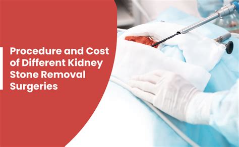 Procedure And Cost Of Different Kidney Stone Removal Surgeries