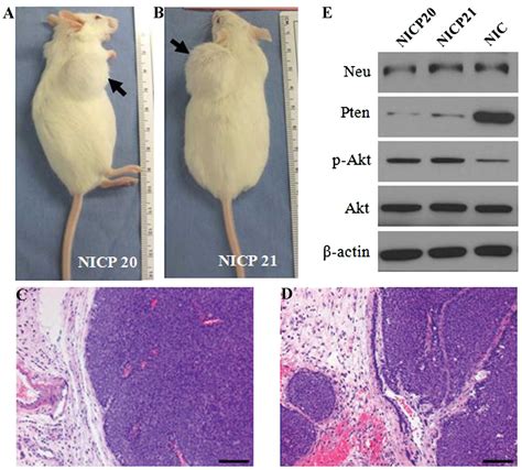 Novel Syngeneic Mouse Mammary Carcinoma Cell Lines From Aggressive