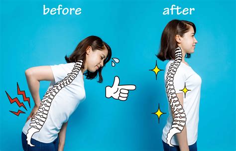4 Tips For Getting Good Back Posture Iphysio Blog