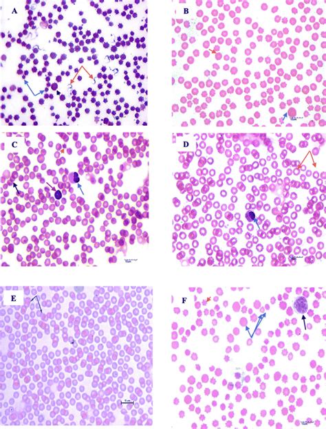 Micrographs Of Stained Blood Smears From Selected Blood Pathogen