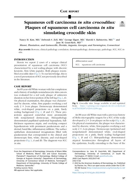 Pdf Squamous Cell Carcinoma In Situ Crocodilus Plaques Of Squamous