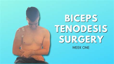 Biceps Tenodesis Surgery Recovery Week One Youtube