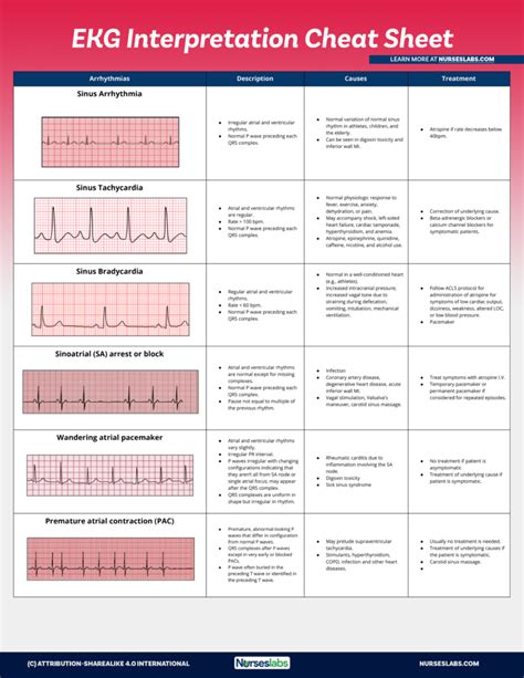 Ekg Interpretation Cheat Sheet Heart Arrhythmias Guide Update