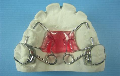 Pendulum Accutech Orthodontic Laboratory Products