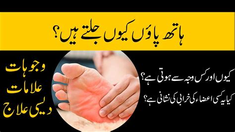 Burning Feet Syndrome Symptoms Causes And Treatment In Urdu By Dr Maqsood Iqbal Youtube