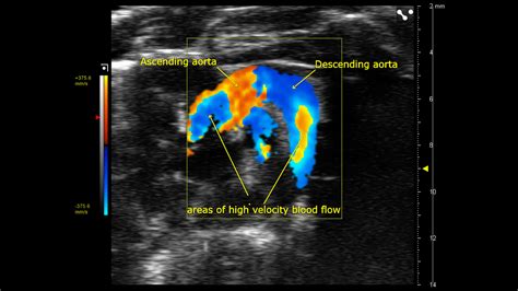 Preclinical Echocardiography For Cardiology Research Fujifilm