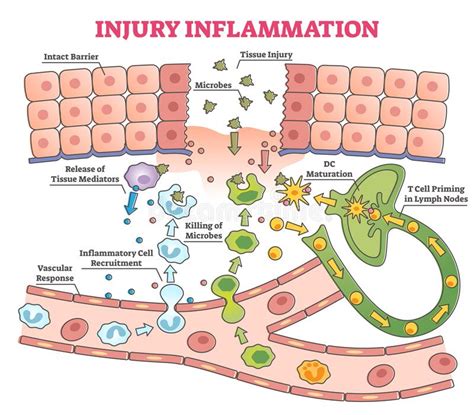 Injury Inflammation Biological Human Body Response Vector Illustration