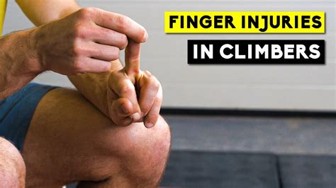 Finger Injuries In Climbers Lattice Training X Sheffield Climbing Clinic Part YouTube