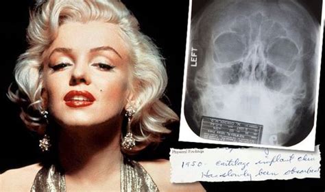 Did Marilyn Have Surgery Medical Records And X Rays Under The Hammer