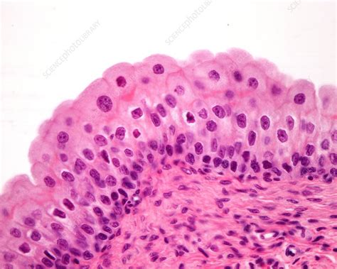 Transitional Epithelium