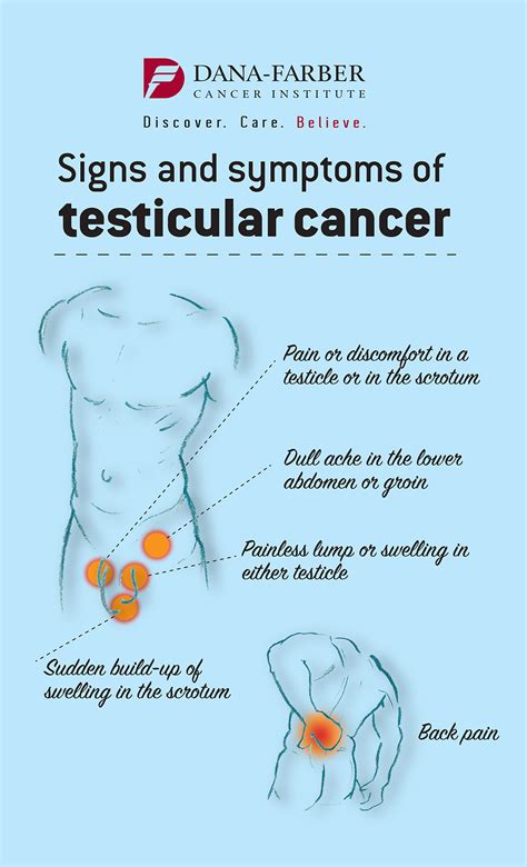 Which Are Clinical Manifestations Of Testicular Cancer Cancerwalls