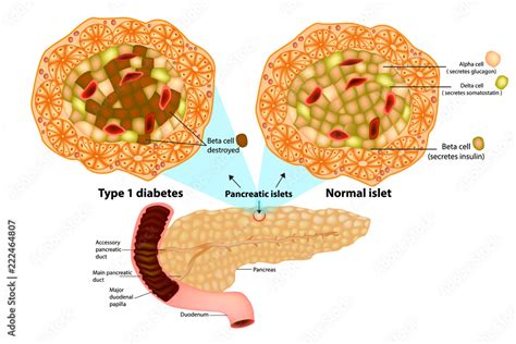 The Pancreas Has Many Islets That Contain Insulin Producing Beta Cells