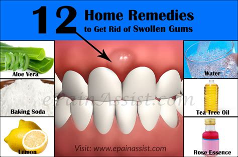 What Causes Swollen Gums And Home Remedies To Get Rid Of It