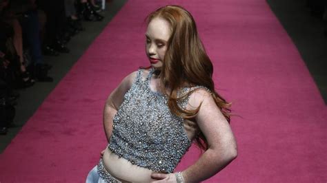 Brisbane Down Syndrome Model Madeline Stuart Launches 21 Reasons Why At
