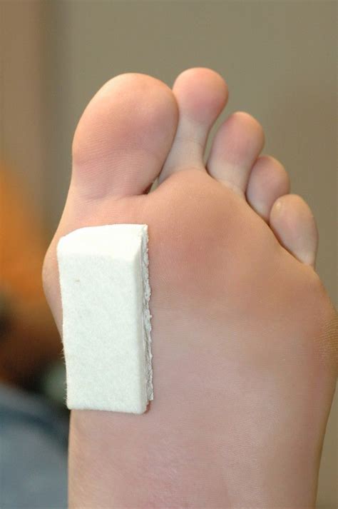Basic Mortons Toe Pad Used For All Problems Of The Body And Foot