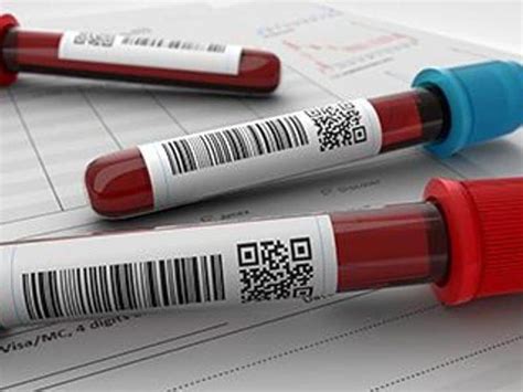 Sex Hormone Binding Globulin May Be Biomarker For Cvd Risk In Men