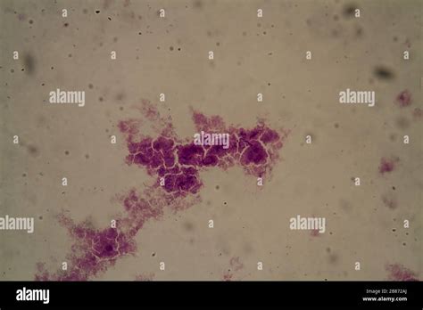 Streptococcus Lactis Bacteria Under The Microscope 400x Stock Photo Alamy