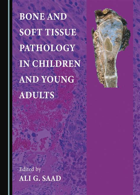 Bone And Soft Tissue Pathology In Children And Young Adults Cambridge