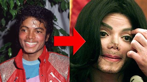 michael jackson why is he white