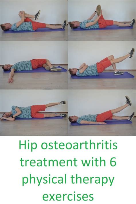 Hip Osteoarthritis Treatment With 6 Physical Therapy Exercises