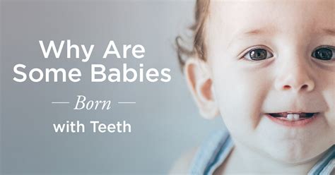 Baby Born With Teeth Is This Normal