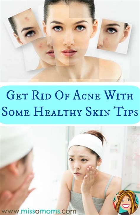 Get Rid Of Acne With Some Healthy Skin Tips Healthy Skin Tips How
