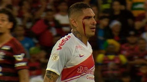 Paolo Guerrero Termin Sangrando Fue Expulsado Del Partido Entre Internacional Vs Flamengo Por