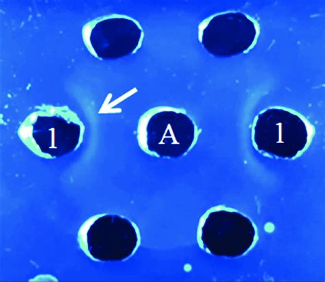 Antibody Specificity Test With Agar Gel Precipitation Test 1 Antigen