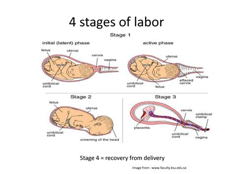 Solution Stages Phases Of Labor Studypool