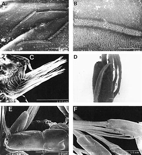 Microscopic Anatomy Of Settled Cypris Larvae Of Octolasmis Californiana Cirripedia Lepadomorpha