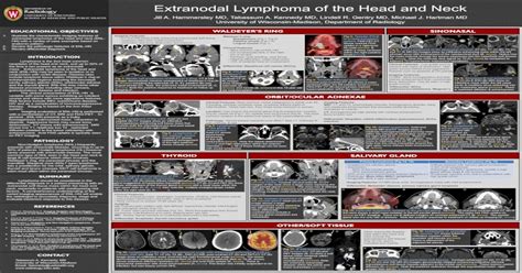 Extranodal Lymphoma Of The Head And Neck · Extranodal Lymphoma Of