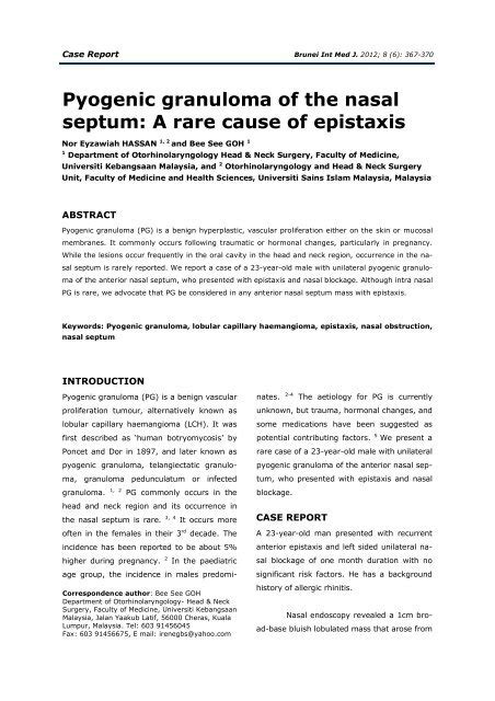 Pyogenic Granuloma Of The Nasal Septum A Rare Cause Of Epistaxis