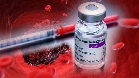 German officials have decided to limit the use of astrazeneca's coronavirus vaccine in people under 60 after more unusual blood clots were reported in a small number of people who received the shots Why can AstraZeneca's COVID-19 vaccine cause life ...