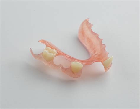 Flexible Partial Dentures At Best Price Dental Lab Direct