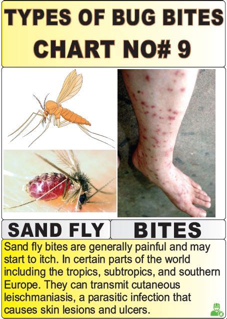 12 Most Harmful Types Of Bug Bites Chart Explained Y L P C