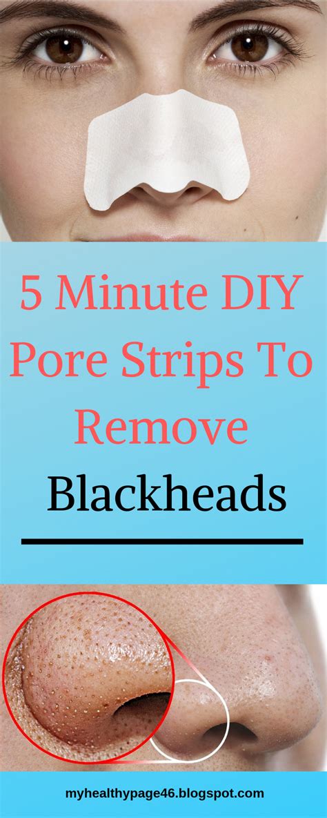 5 Minute Diy Pore Strips To Remove Blackheads With Images Pore