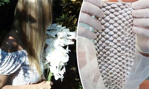 Transgender Woman Gets New Vagina Made From Fish Skin Page My Xxx Hot