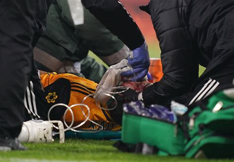 Wolves captain conor coady says it is amazing to see raul jimenez back on the pitch after returning from a fractured skull injury suffered against arsenal last november. Manchester United stars wish Raul Jimenez well after ...