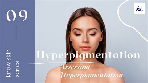 Hyperpigmentation Series Assessing Hyperpigmentation Youtube