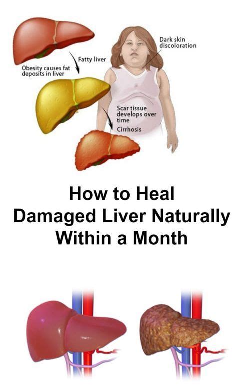 The Function Of The Liver Has Always Been To Filter Out Toxins And
