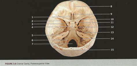 Cranial Cavity Posterosuperior View Diagram Quizlet